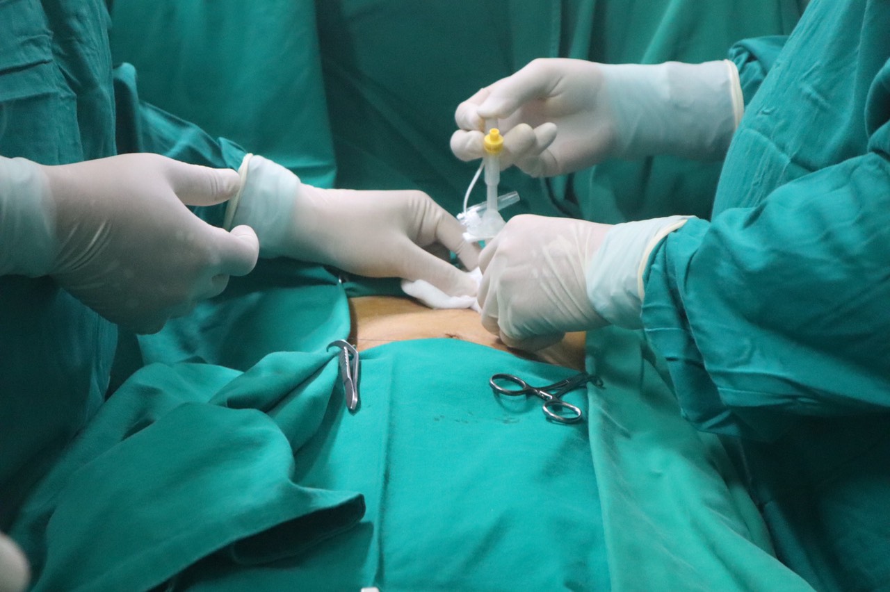 TTYT huyện Tiên Du triển khai kỹ thuật Mở thông dạ dày bằng phẫu thuật nội soi
